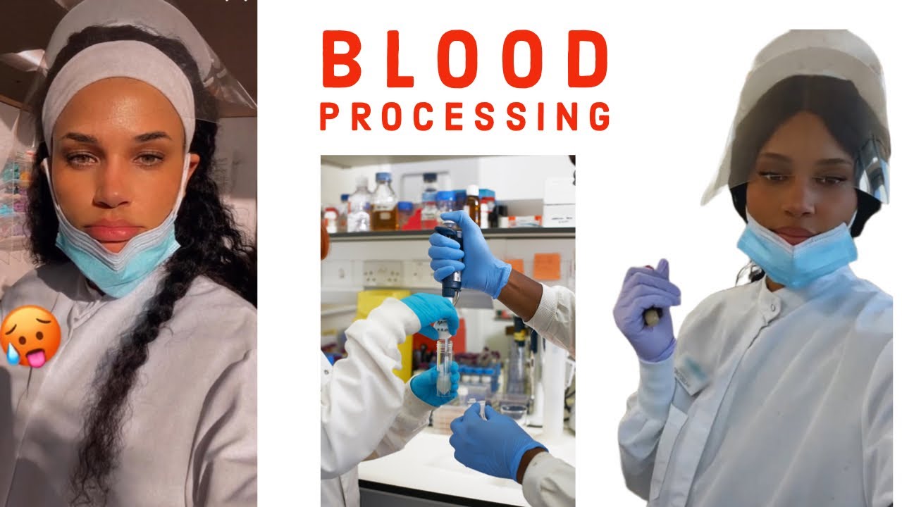 Blood processing in the laboratory 🩸