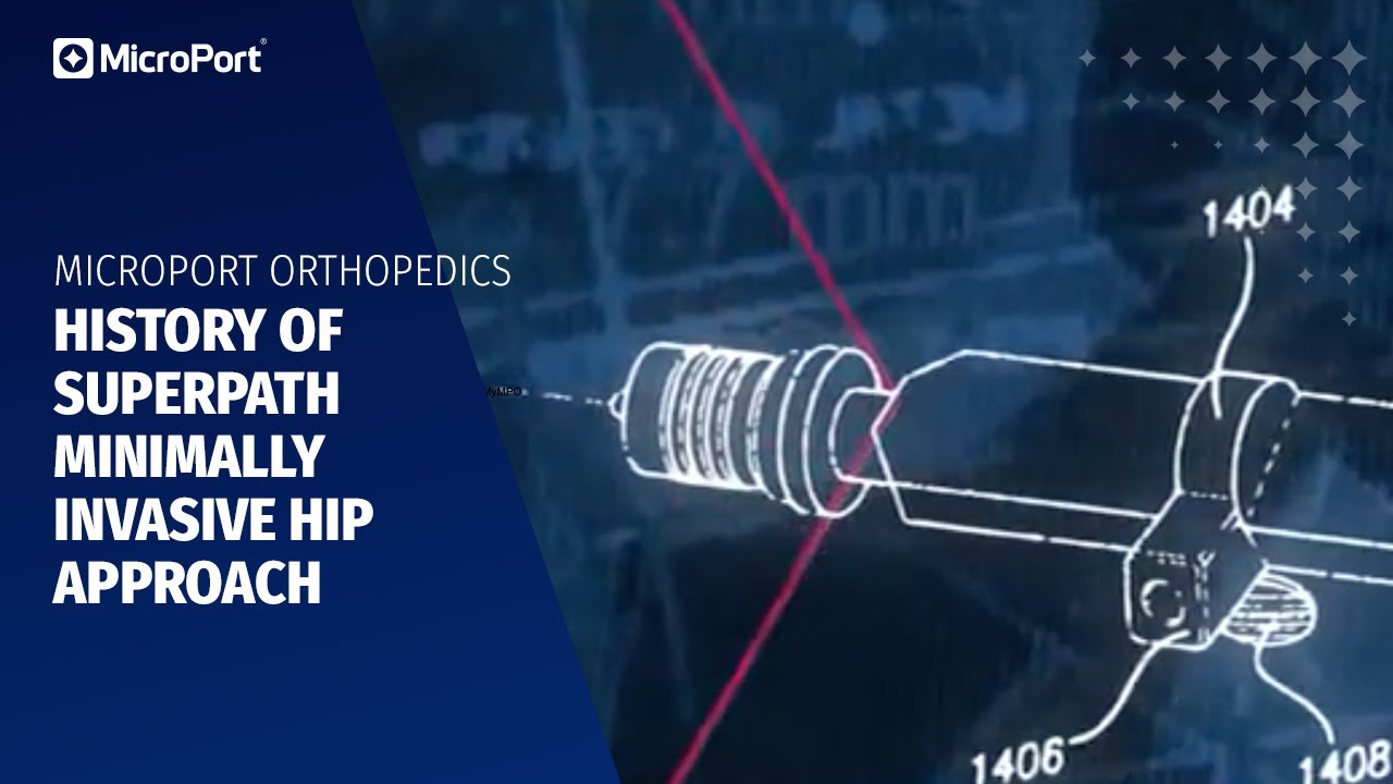 History of SuperPath Minimally Invasive Hip Approach