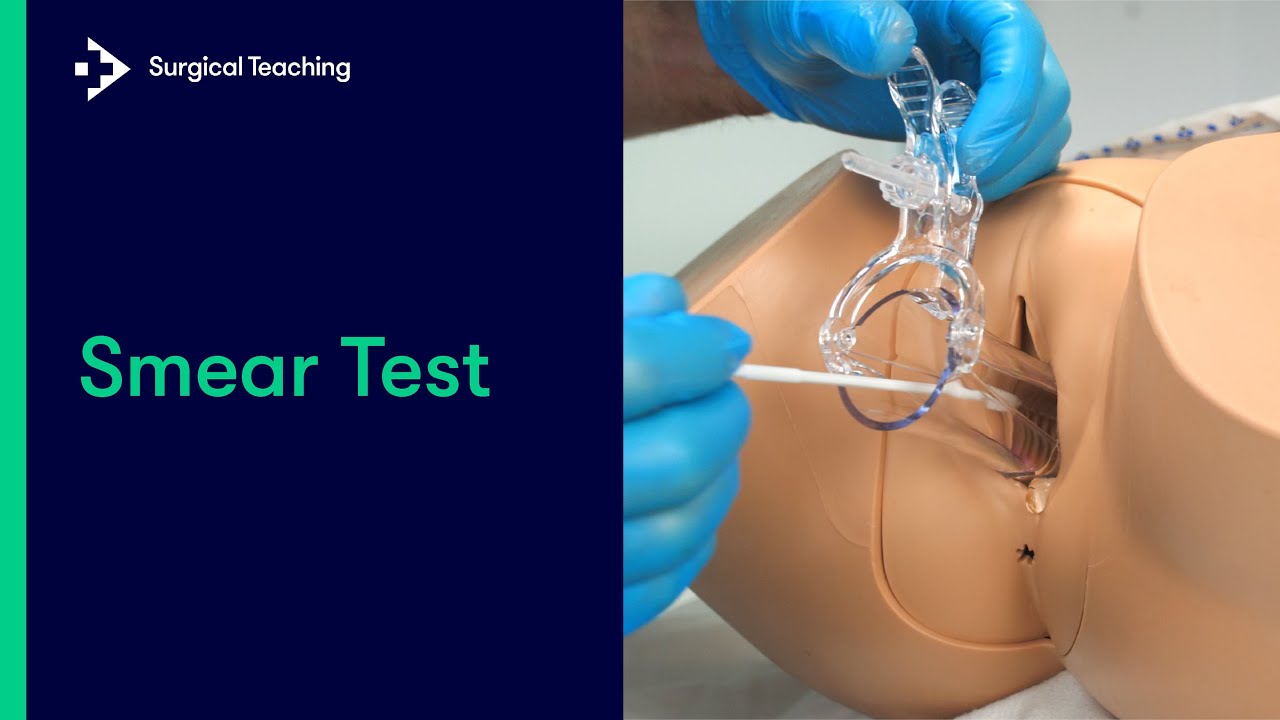 How to Perform a Pap Smear