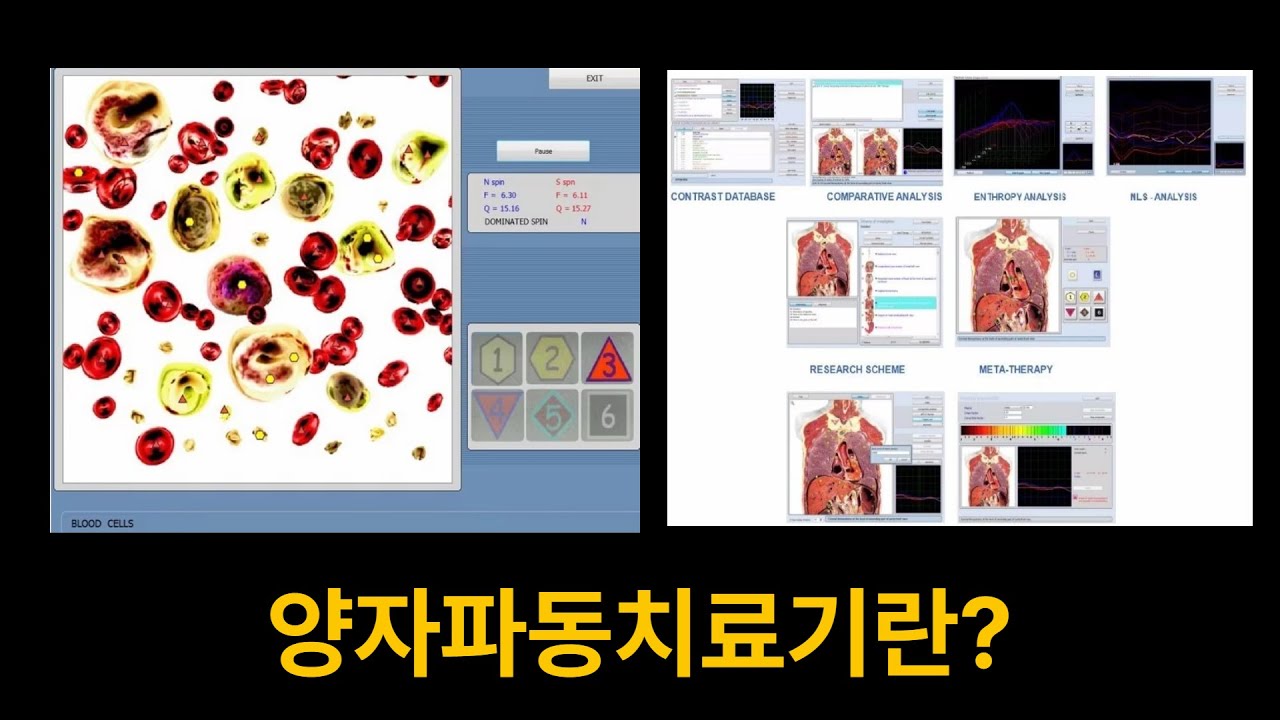 양자파동치료기란?