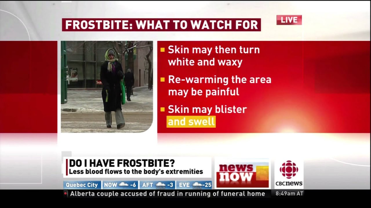 Frostbite Prevention [Dr. Karl]