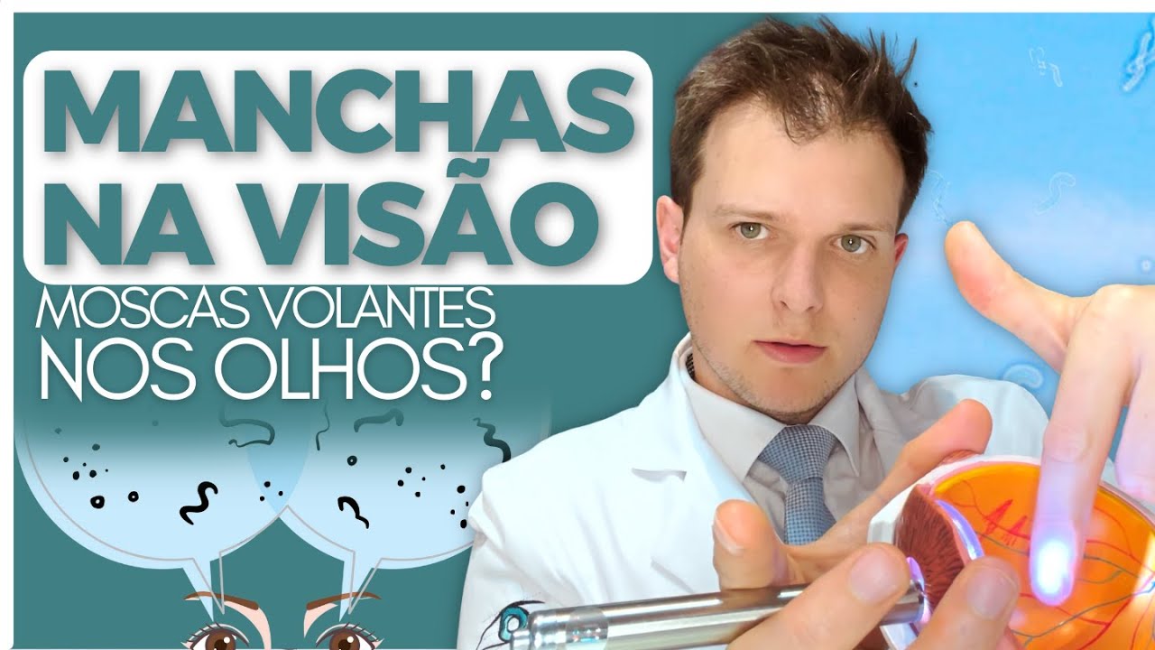 O que s&atilde;o moscas volantes nos olhos?