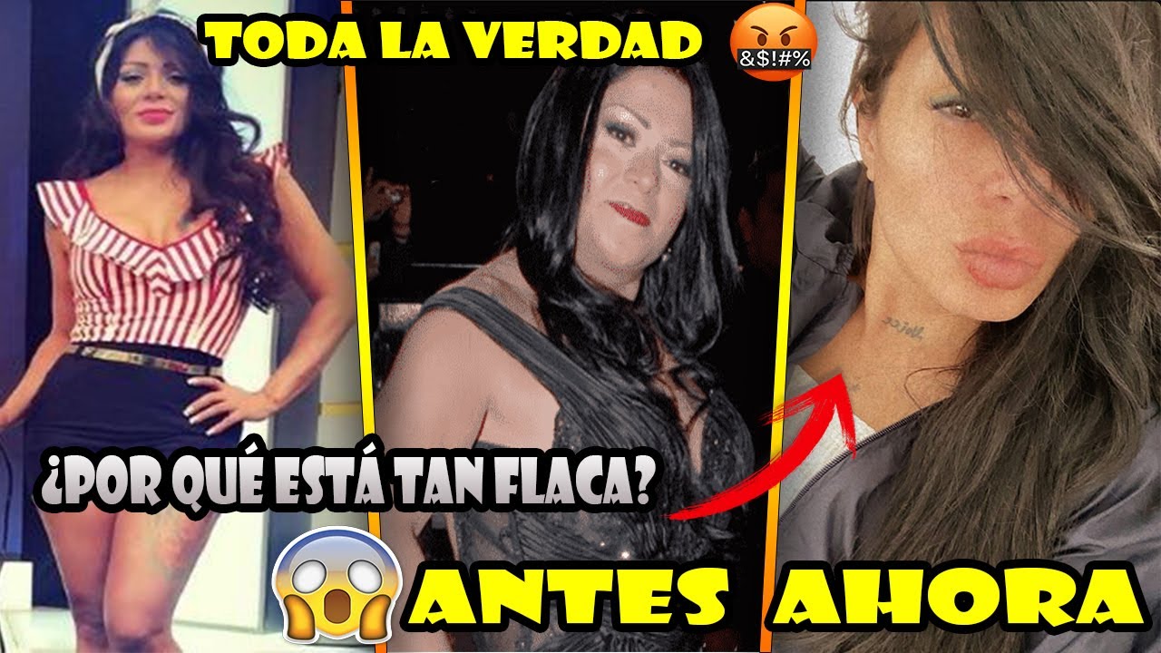 Todas Las Cirugías de Marbelle y por qué está tan Delgada ¿Embarazada? | Amor sincero
