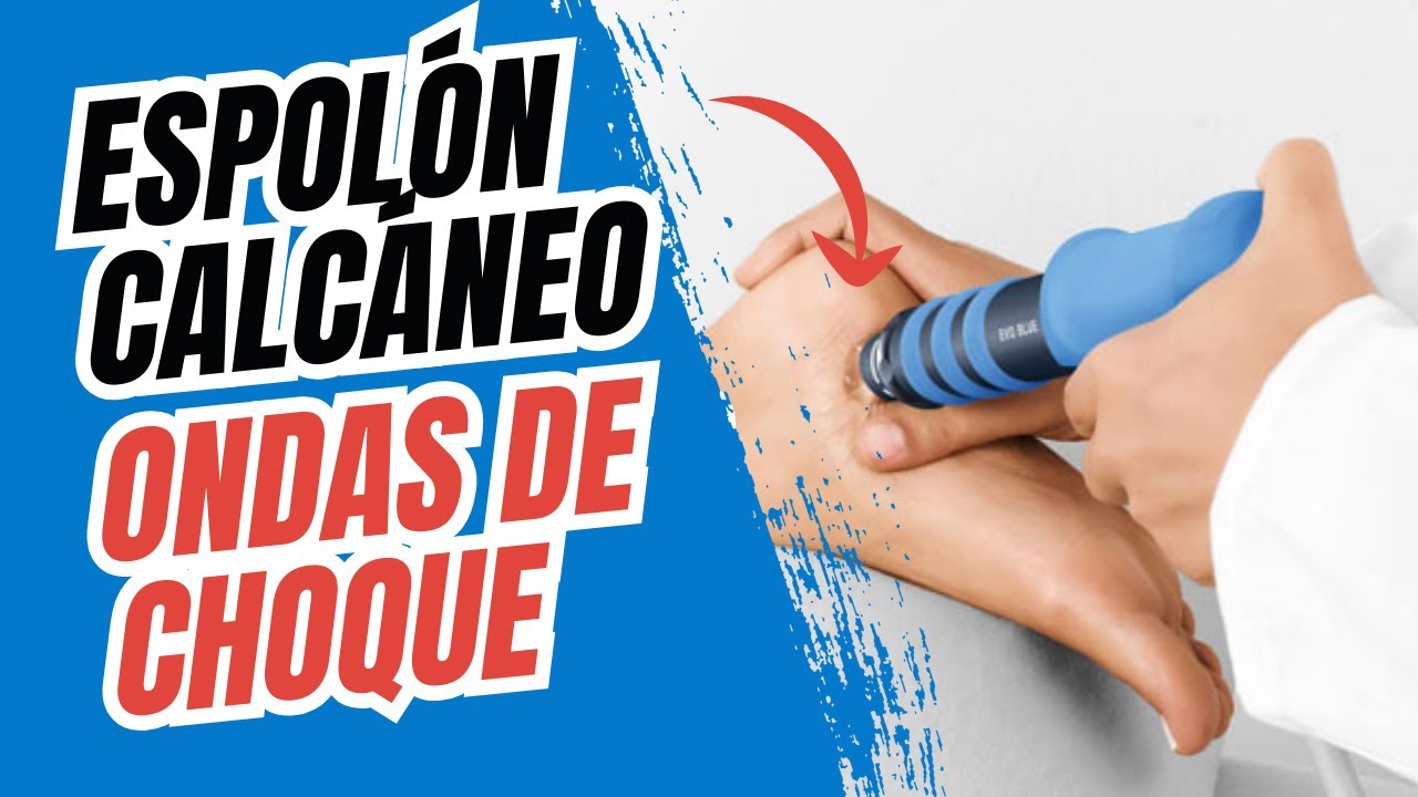 ESPOL&Oacute;N CALC&Aacute;NEO: &iquest;Son EFECTIVAS las ONDAS DE CHOQUE?