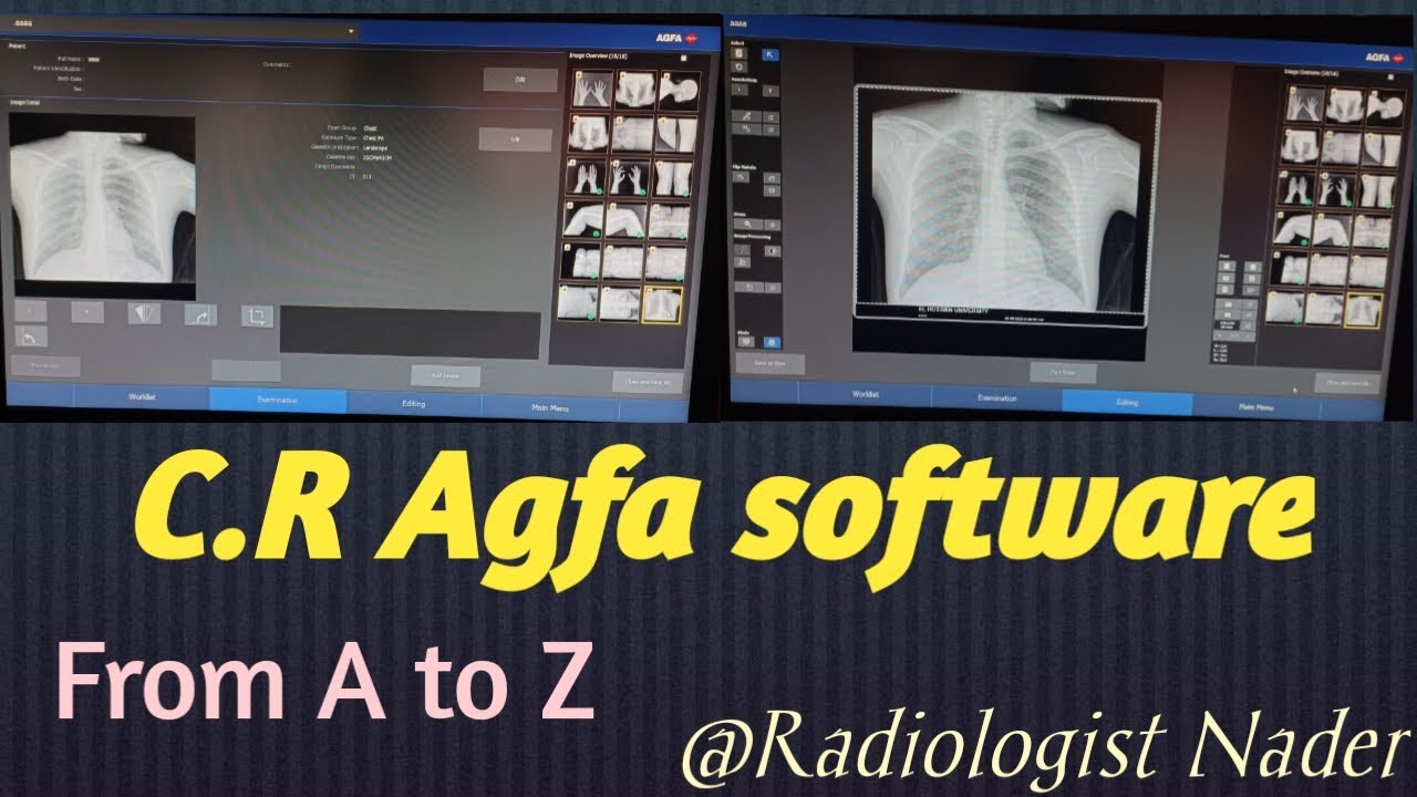 شرح سوفت وير جهاز سي آر اجفا |C.R Agfa software