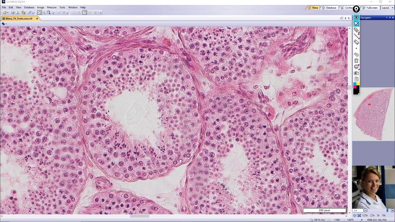 testis (varle)