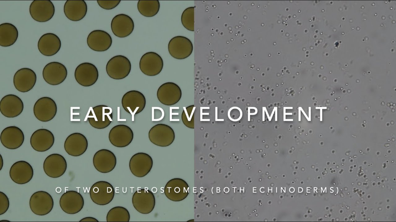 Development