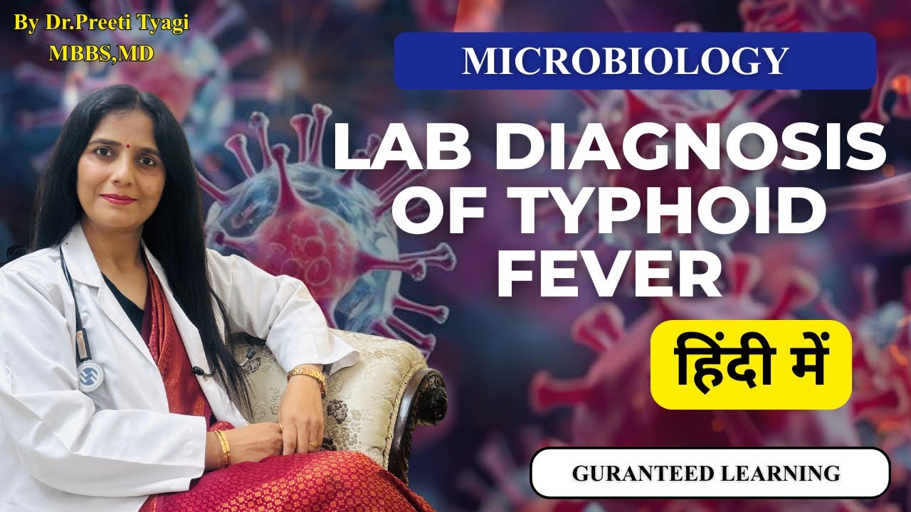 LAB DIAGNOSIS OF TYPHOID FEVER