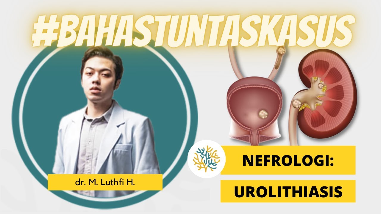 UKMPPD Session #31 | Nefrourologi : Urolithiasis / Batu Saluran Kemih (Lokasi, Jenis Batu, dll)