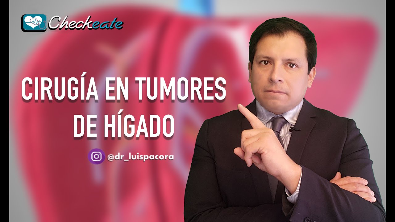 CIRUGÍA EN TUMORES DE HÍGADO ❗️ APRENDIENDO CONCEPTOS DE LAS RESECCIONES HEPÁTICAS