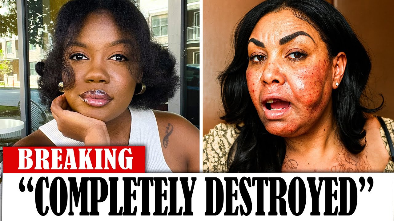 20 Black Actors Who RUINED Their Careers With PLASTIC SURGERY