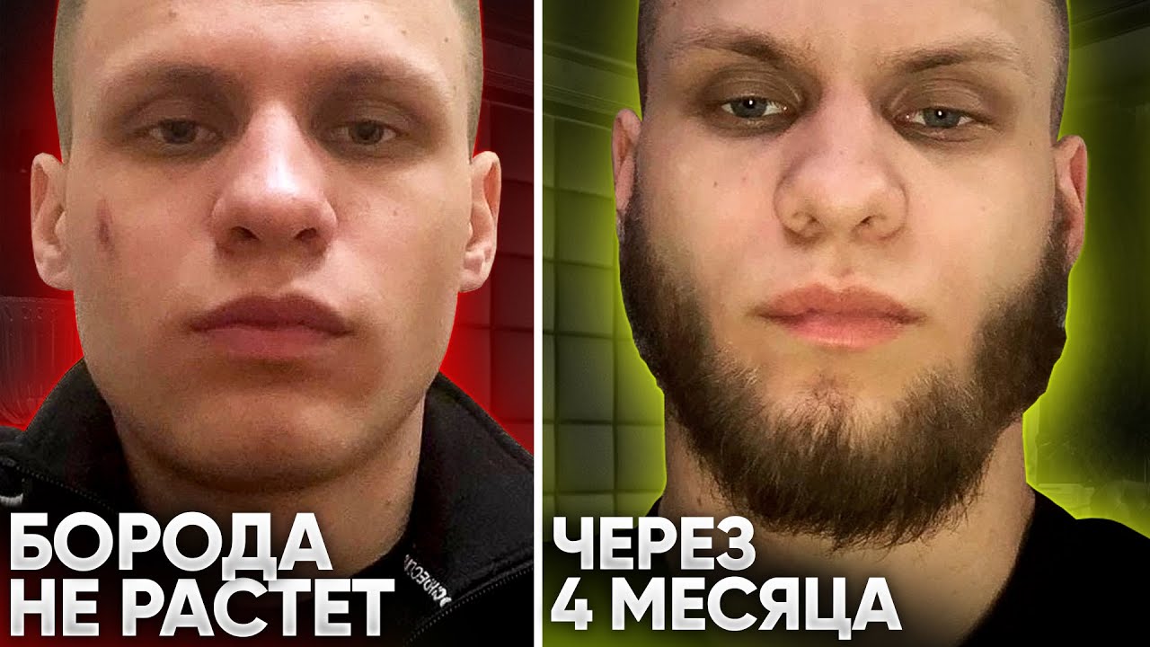 ИЗ МАЛЬЧИКА В БРУТАЛА за 4 месяца / Результаты средств для роста бороды