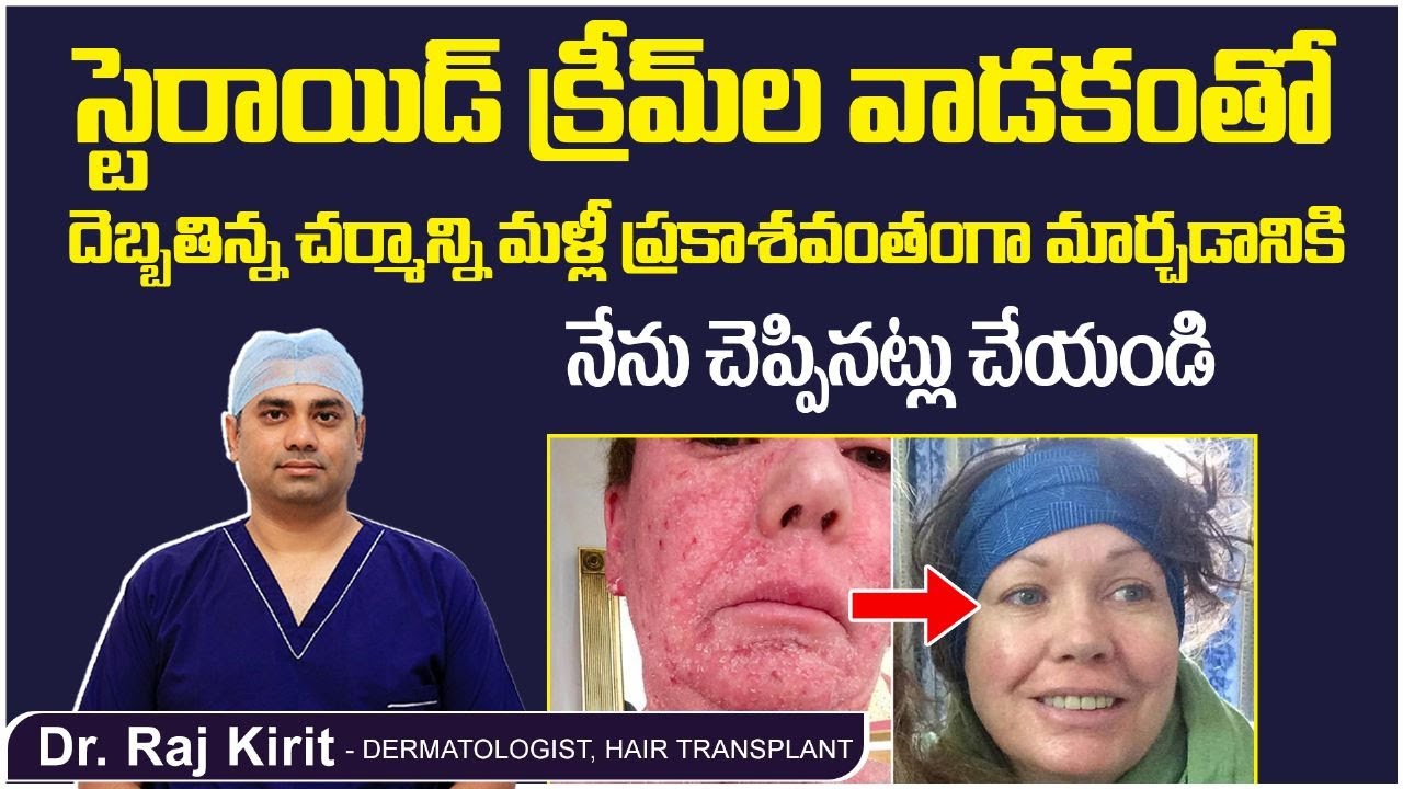 Top Methods To Repair Steroid Damaged Skin In Telugu | Skin Care | Dr Raj Kirit | Celestee Clinic