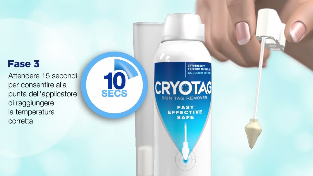 Rimuovere fibromi penduli o porri sulla pelle con Cryotag Skin Tag Remover - Efficacia comprovata