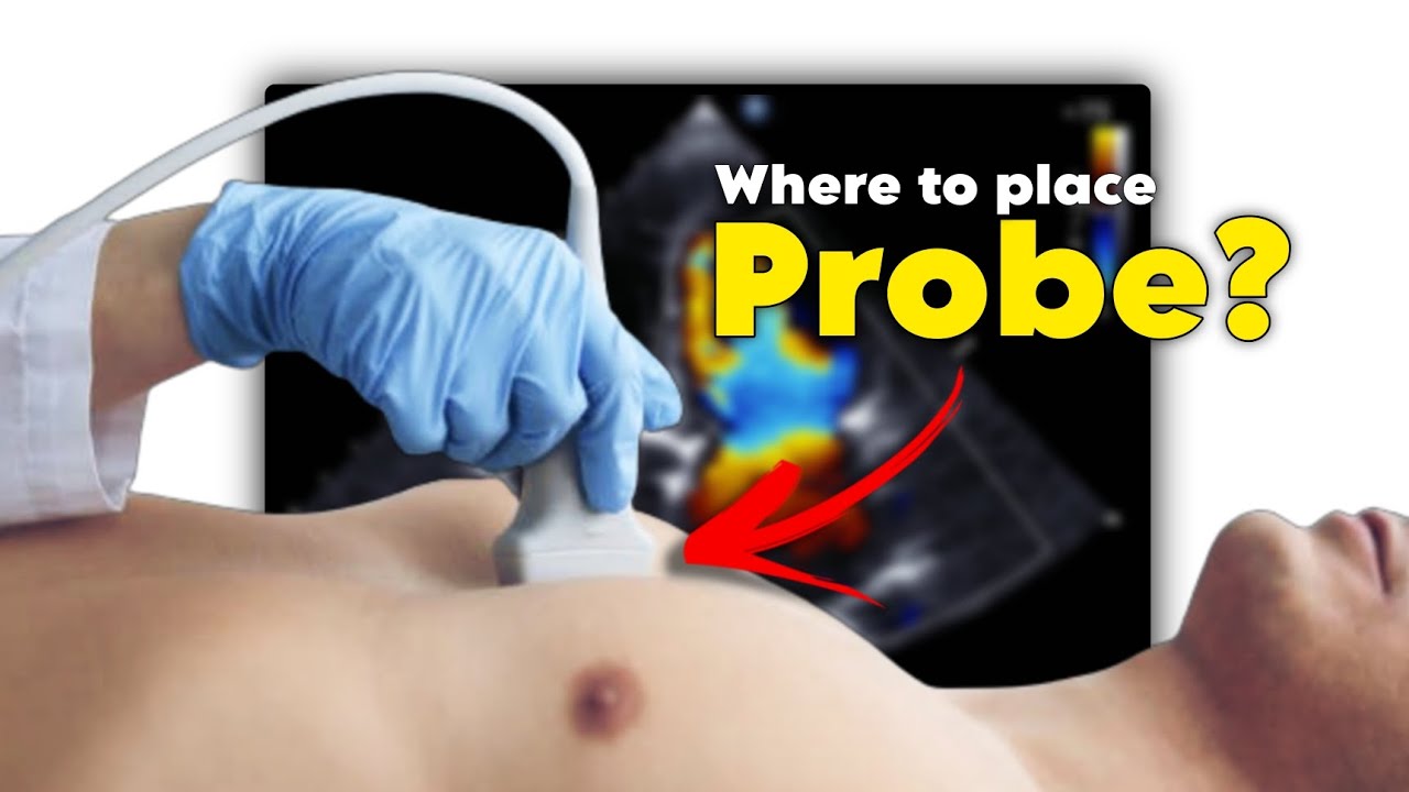 The Art of Probe Positioning: Mastering 2D Echo