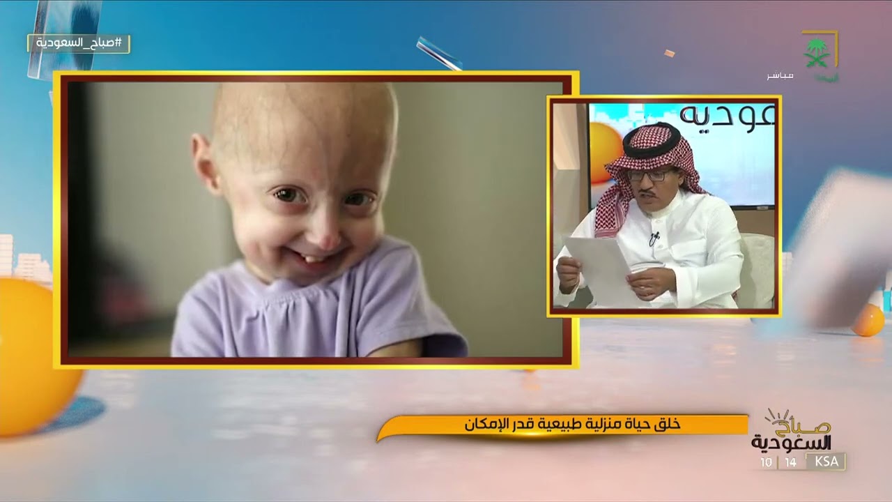 الشيخوخة المبكرة عند الأطفال الأسباب وطرق العلاج.. د. خالد المنيع