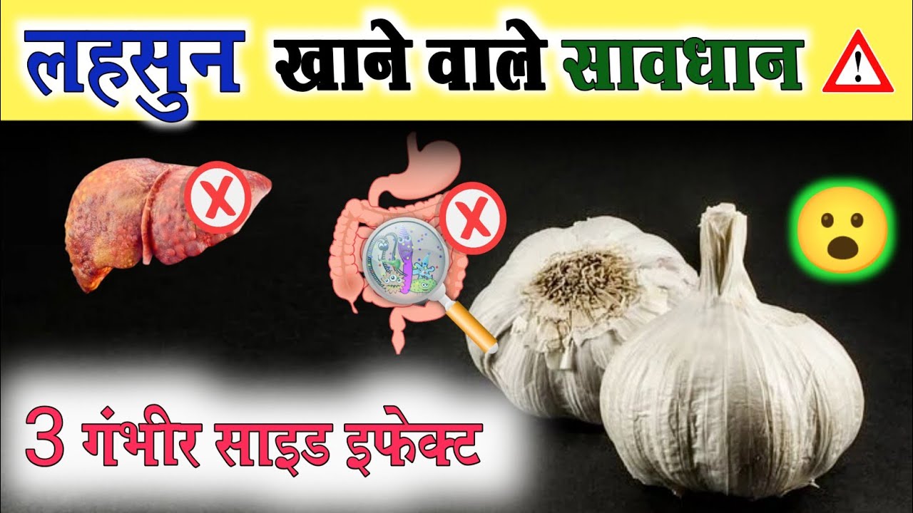 ज्यादा लहसुन से होगा ये नुकसान - jyada lahsun khane ke side effects, Garlic, Lahsun | side effects