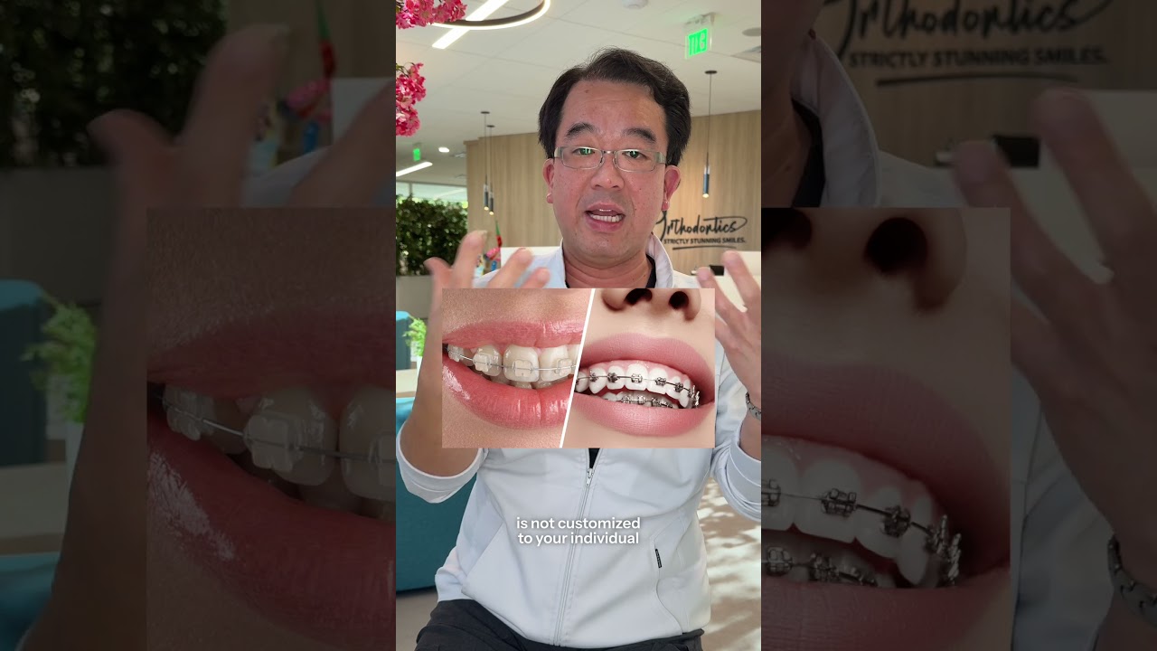 Lightforce v Regular Brace. What&rsquo;s the difference? #orthodontist #braces #lightforce