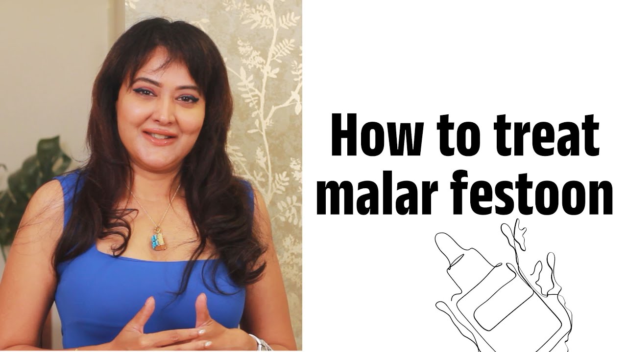 Best ways to treat Malar Festoon | Dr. Shuba Dharamana | Dermatologist | Lejeune Medspa