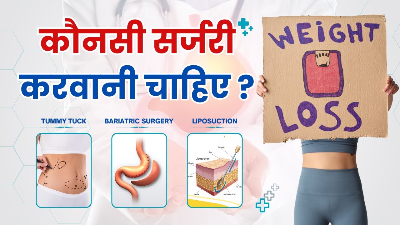 Know The Difference Between Bariatric Surgery and Tummy Tuck Surgery or Liposuction For Weight Loss