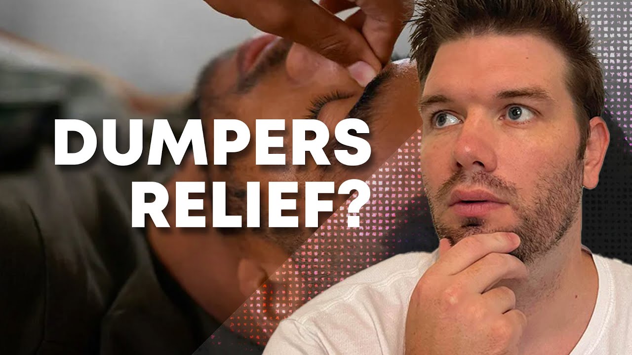 Why Your Ex Probably Has Dumpers Relief?
