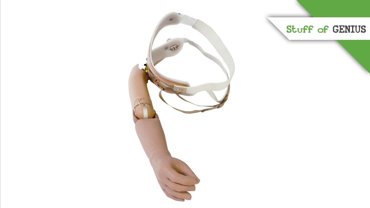 Chaz Holder and the (Modern) Prosthetic Limb