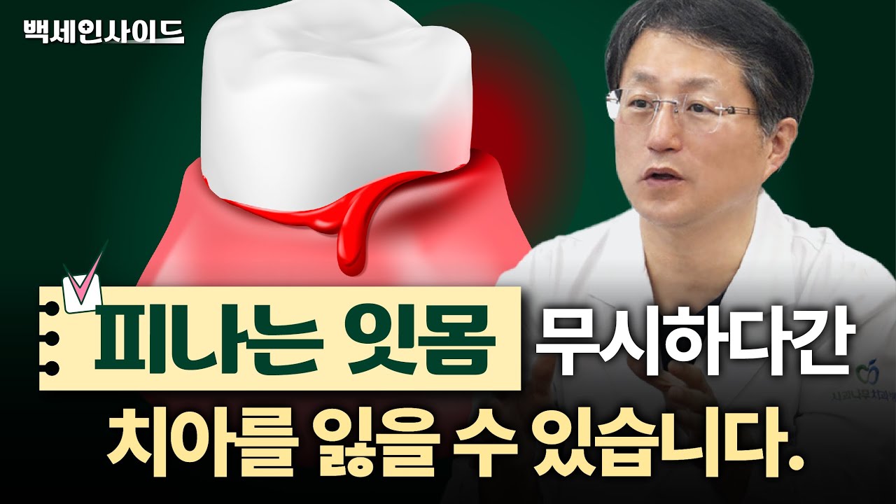 잇몸에서 피 날 때 방치하면 안 되는 이유