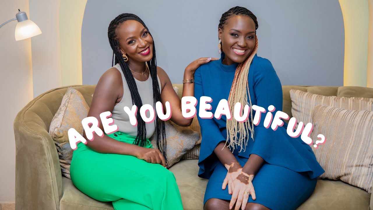 My Journey with Vitiligo and discovering TRUE BEAUTY | School life, Relationships and Lessons
