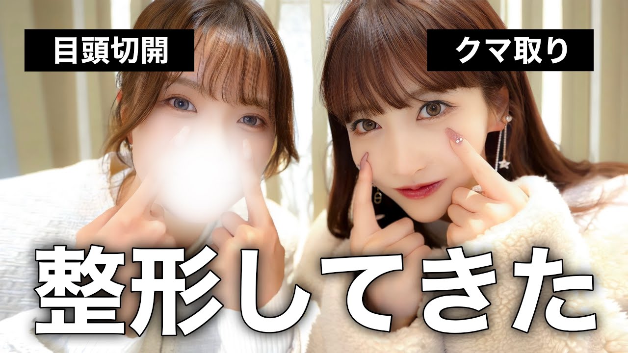【整形】またマネ子と2人で整形してきて大満足！！クマ取り・目頭切開レポ。