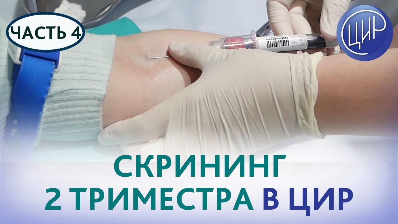 ВТОРОЙ СКРИНИНГ - комбинированный скрининг второго триместра. Беременность в ЦИР. Часть 4.