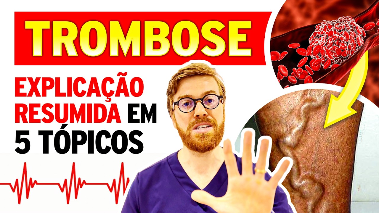 TROMBOSE nas Pernas: Tudo o que Você Precisa Saber e Ninguém Conta (Sintomas, Riscos e Tratamentos)!