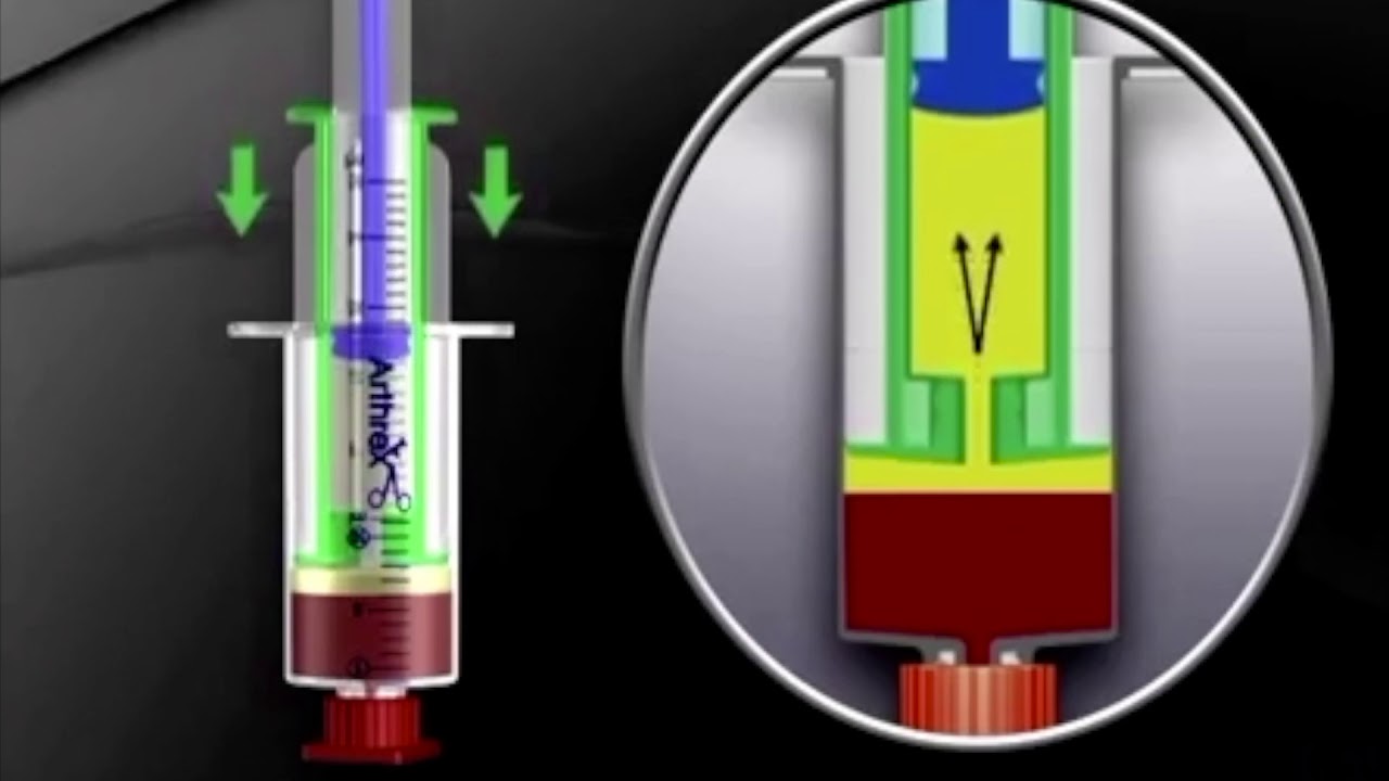 OBTENCIÓN DEL PRP (PLASMA RICO EN PLAQUETAS) 💉