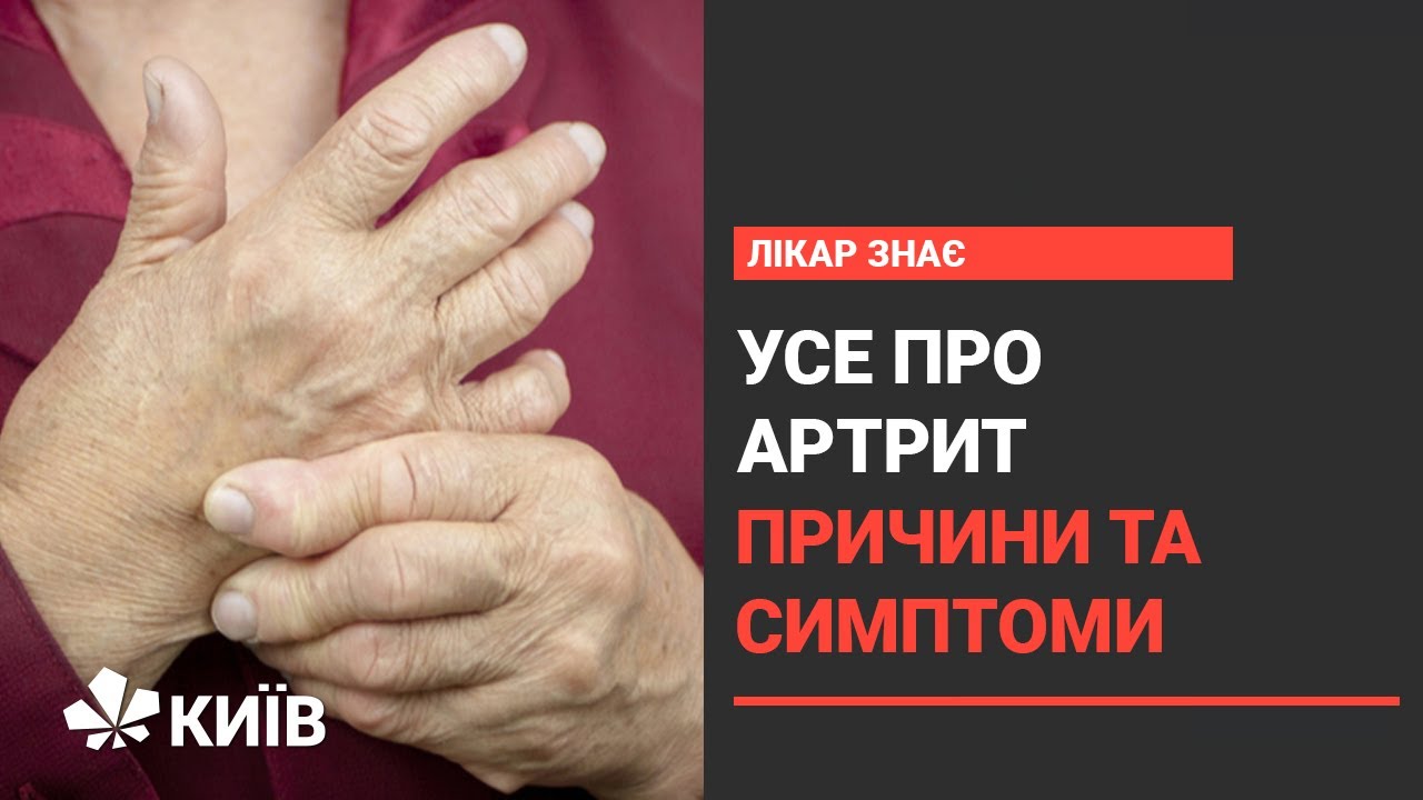 Артрит: що робити, якщо болять суглоби