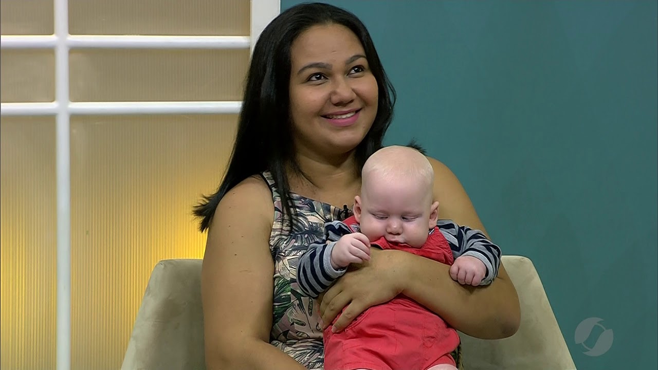 JSD (19/06/19) - Bebê albino recebe ajuda e tratamento