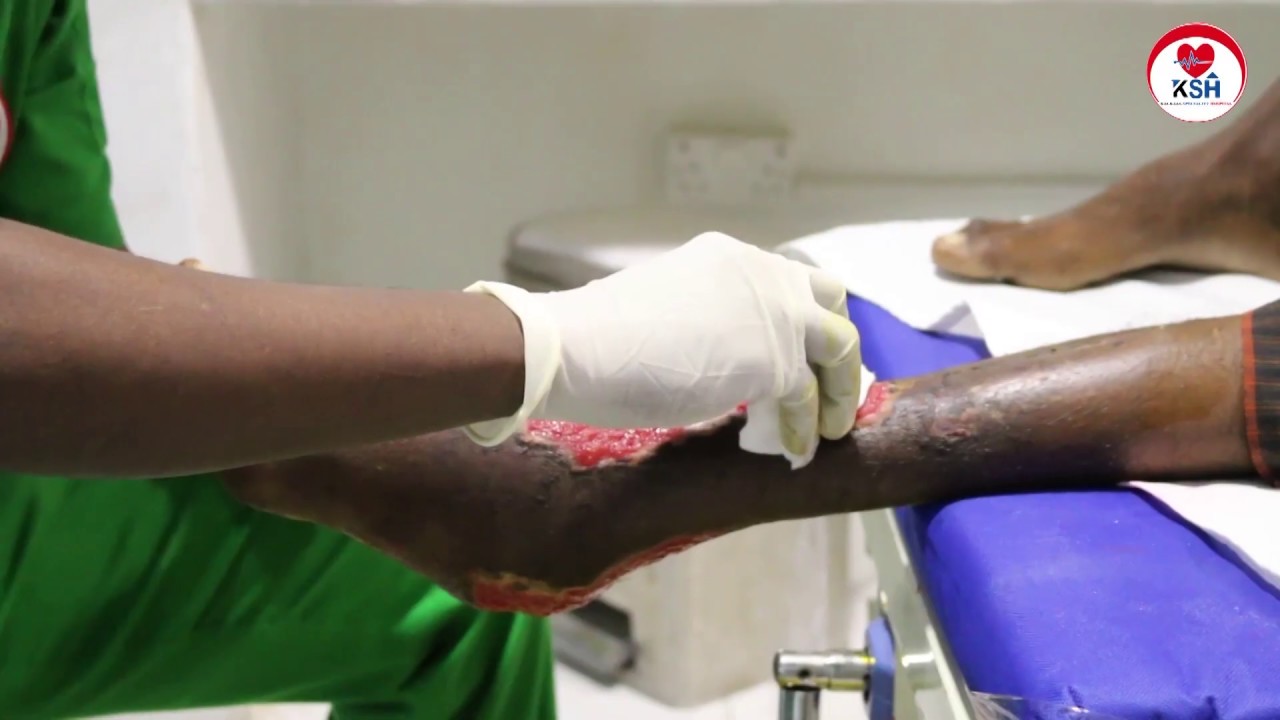 mid kamid ah bukaanda lafaha oo qaliin loo sameyay