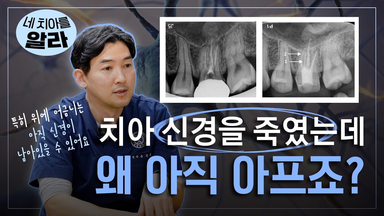 치아 신경을 죽였는데 왜 아직 아프죠?