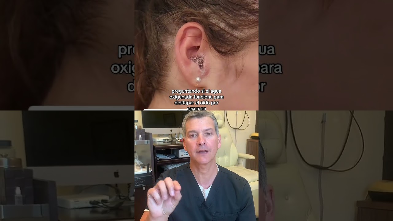El agua oxigenada sirve para destapar el oido⁉️ #doctor #cirujano #mexico