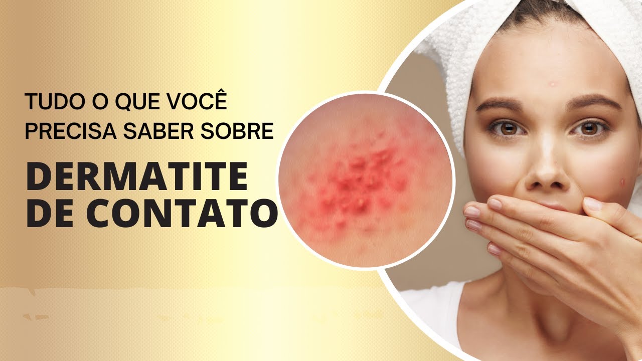Tudo o que você precisa saber sobre Dermatite de Contato