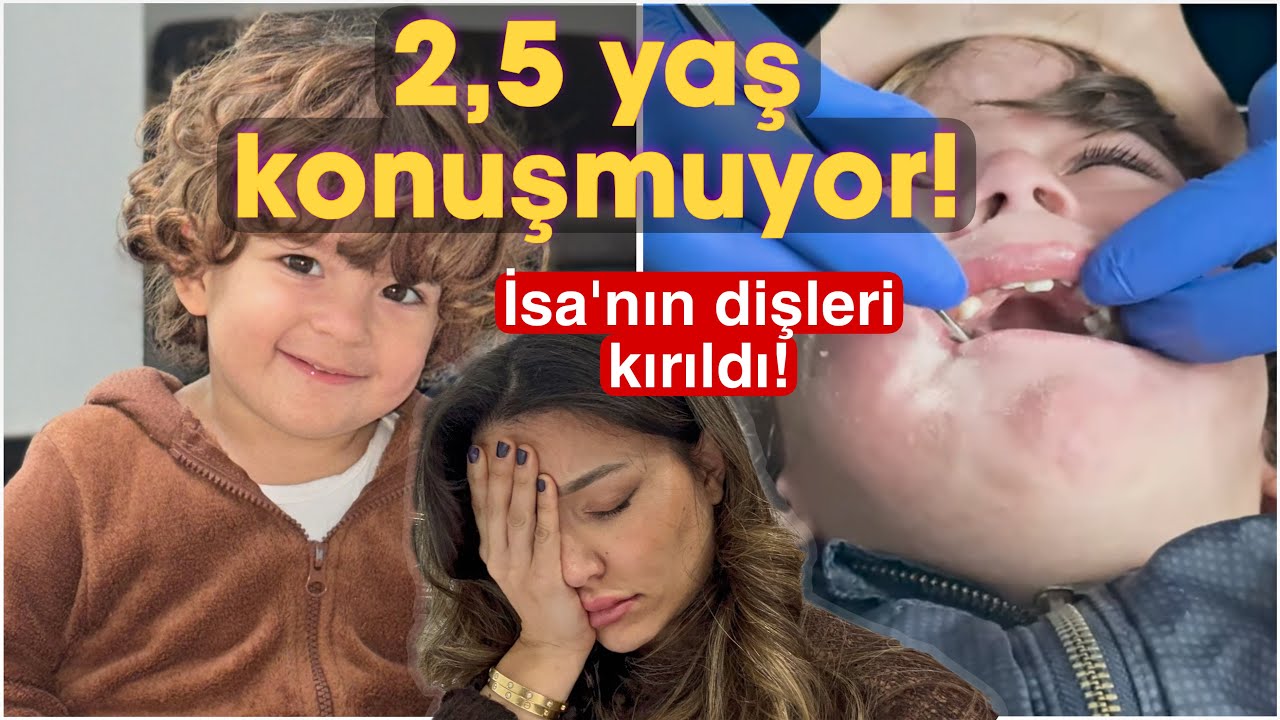 2,5 yaşındaki oğlumuz konuşmuyor | Isa’nın dişleri kırıldı | Konuşma gecikmesi