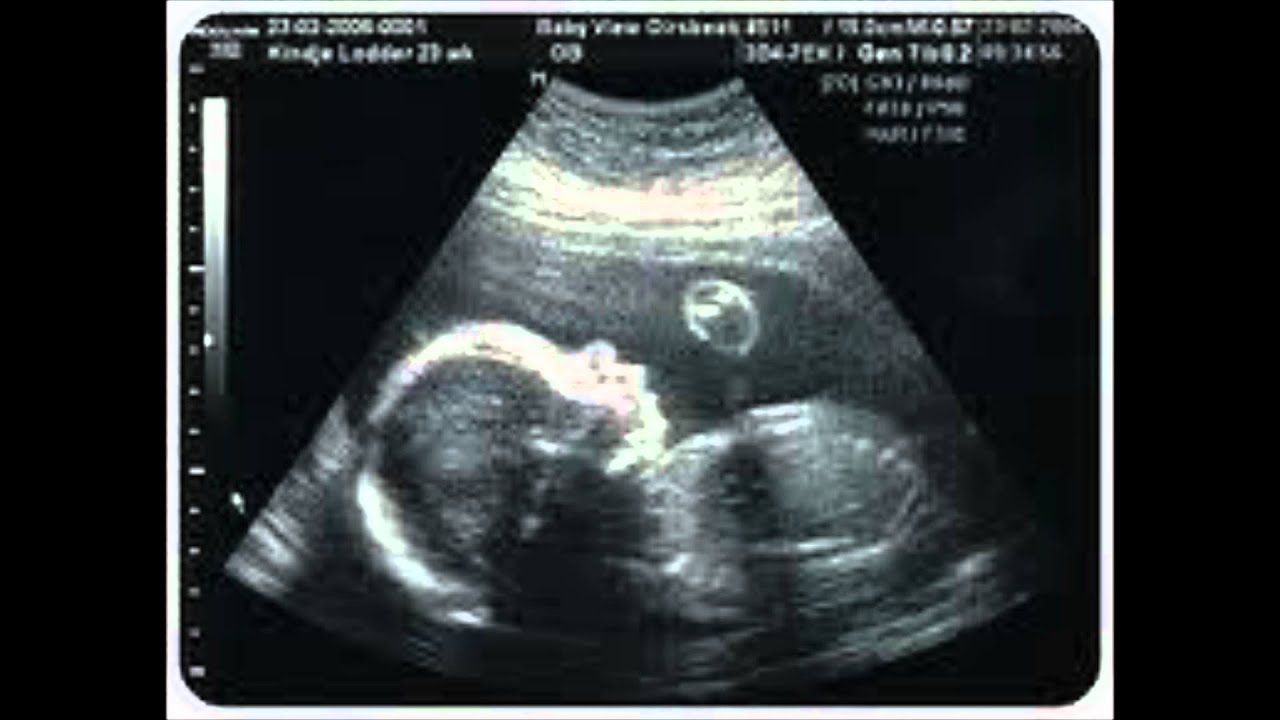 Ana Ruiz - En rosa o azul.wmv