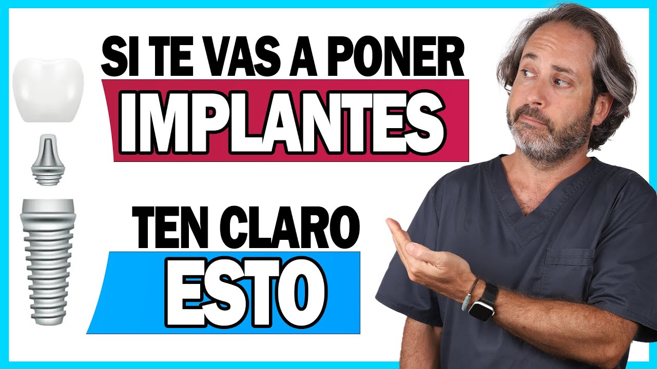 📌𝗜𝗡𝗙𝗢𝗥𝗠𝗔𝗖𝗜𝗢𝗡 𝗖𝗟𝗔𝗩𝗘 sobre la 𝗖𝗢𝗟𝗢𝗖𝗔𝗖𝗜𝗢𝗡 𝗜𝗠𝗣𝗟𝗔𝗡𝗧𝗘𝗦 dentales paso a paso explicada  (TE INTERESA 👌)