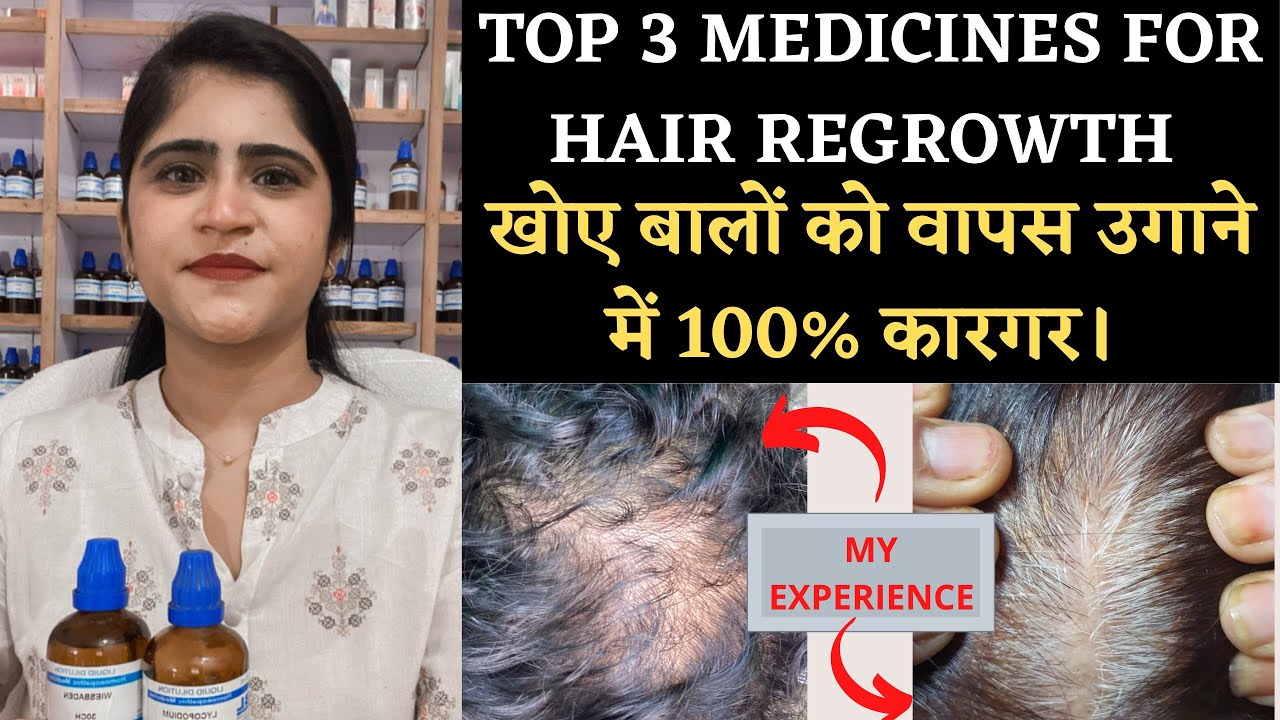 Top 3 Hair Regrowth Medicines||खोए बालों को वापस उगाने में 100% कारगर।।#hairfall