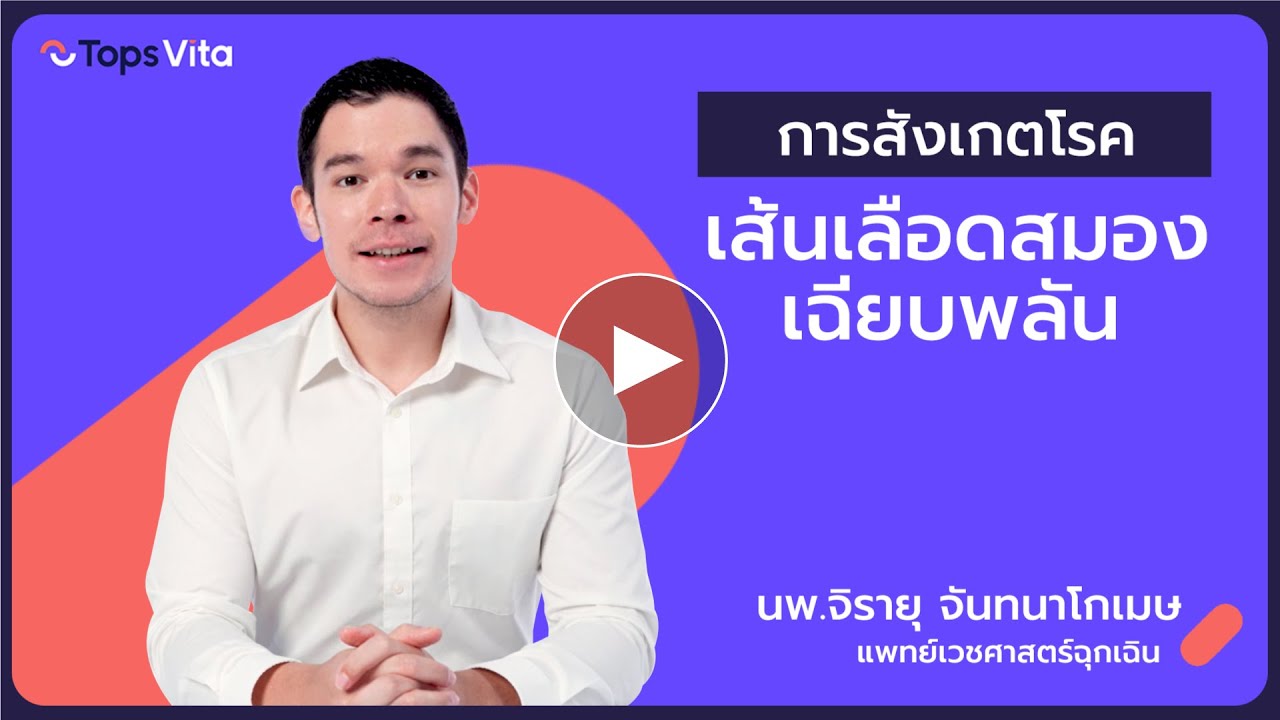การสังเกตโรคเส้นเลือดสมองเฉียบพลัน  | Tops Vita