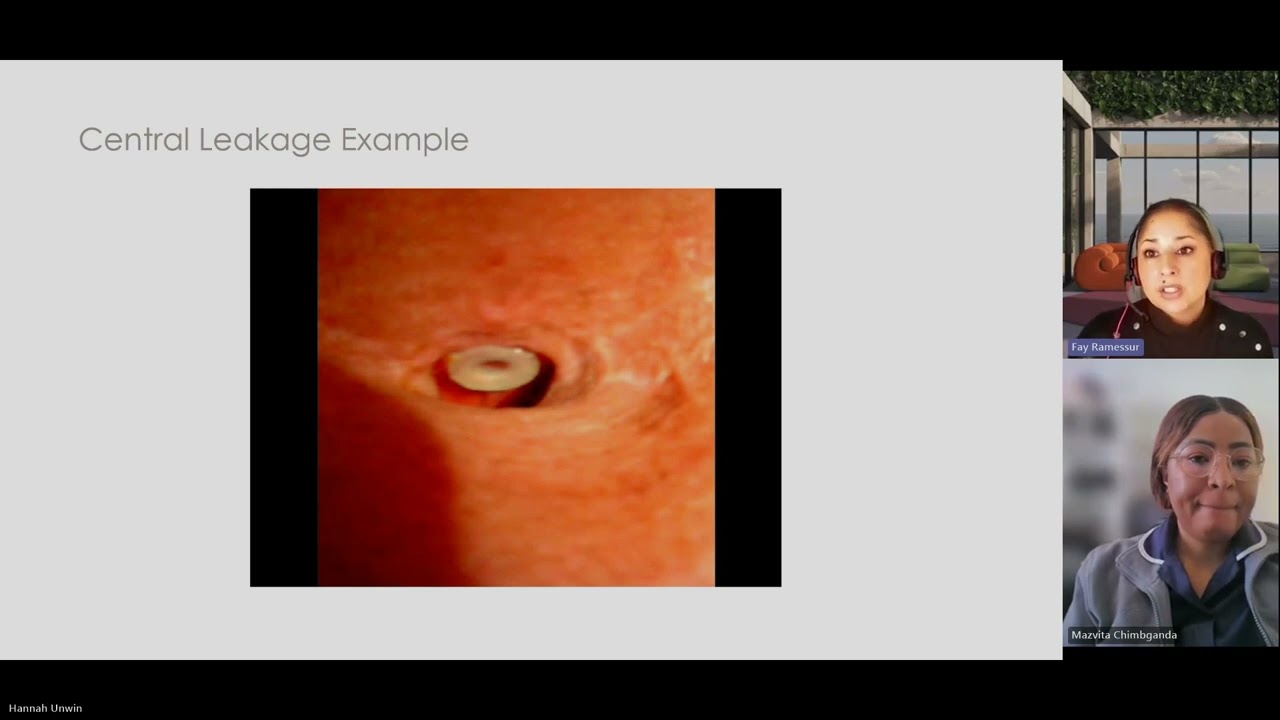 What to do if you're voice prosthesis leaks