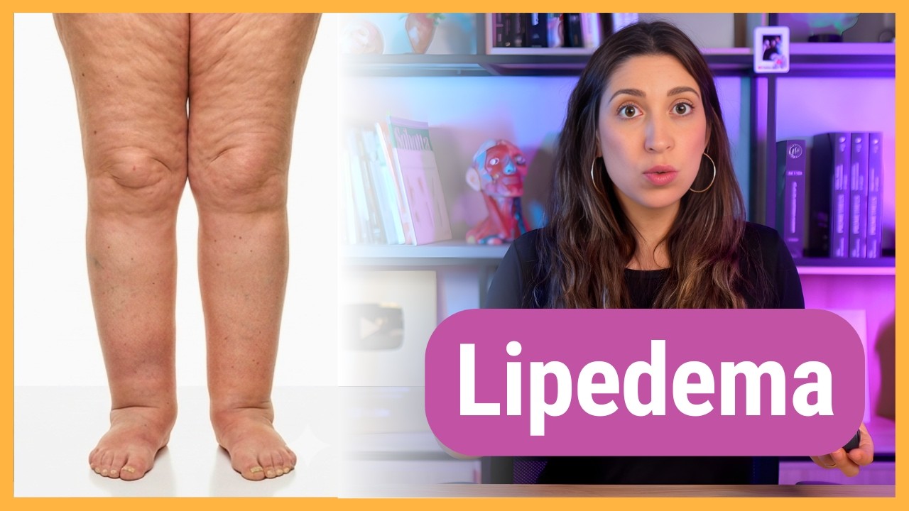 LIPEDEMA: o que é, causas e tratamento