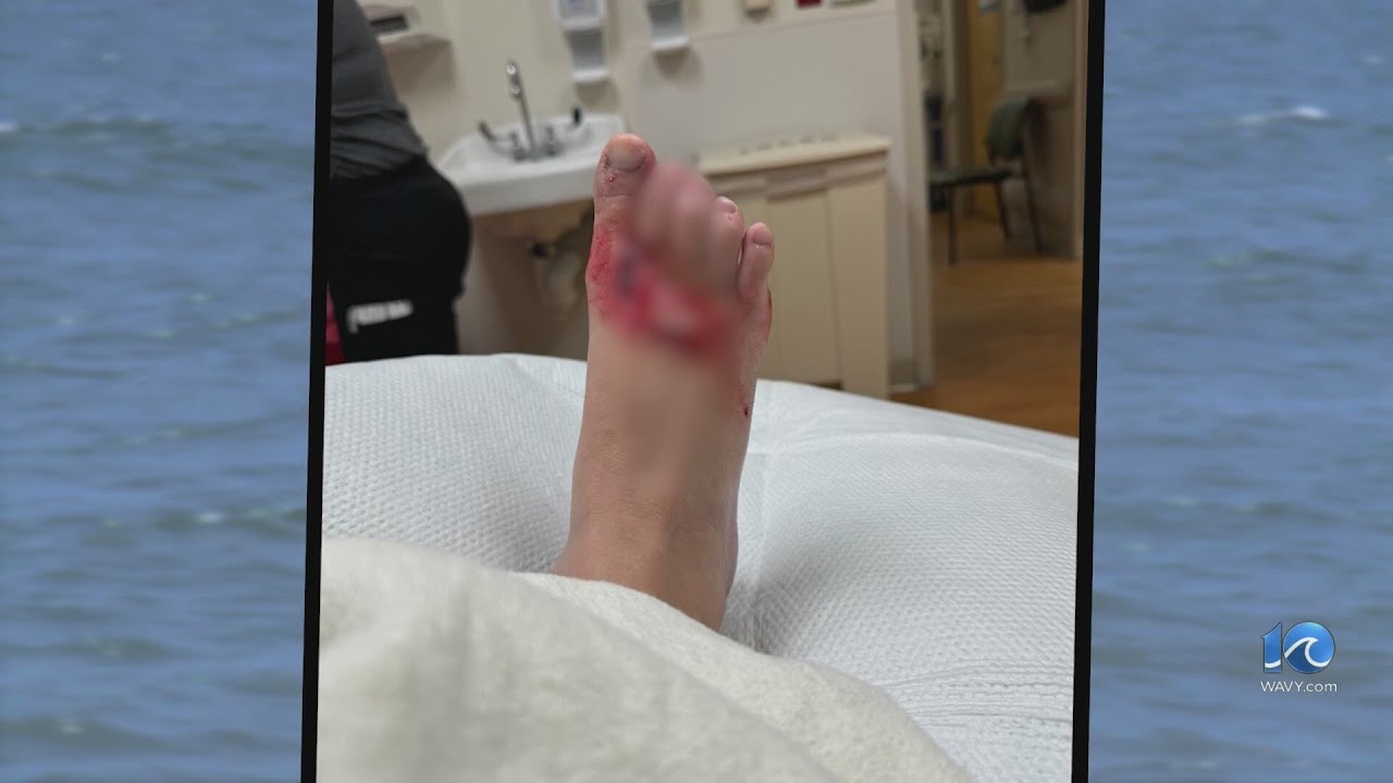 4 marine life bite victims in Virginia Beach this past week, officials say