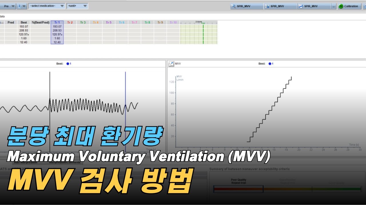 Vyntus 장비 MVV (분당 최대 환기량) 검사 방법