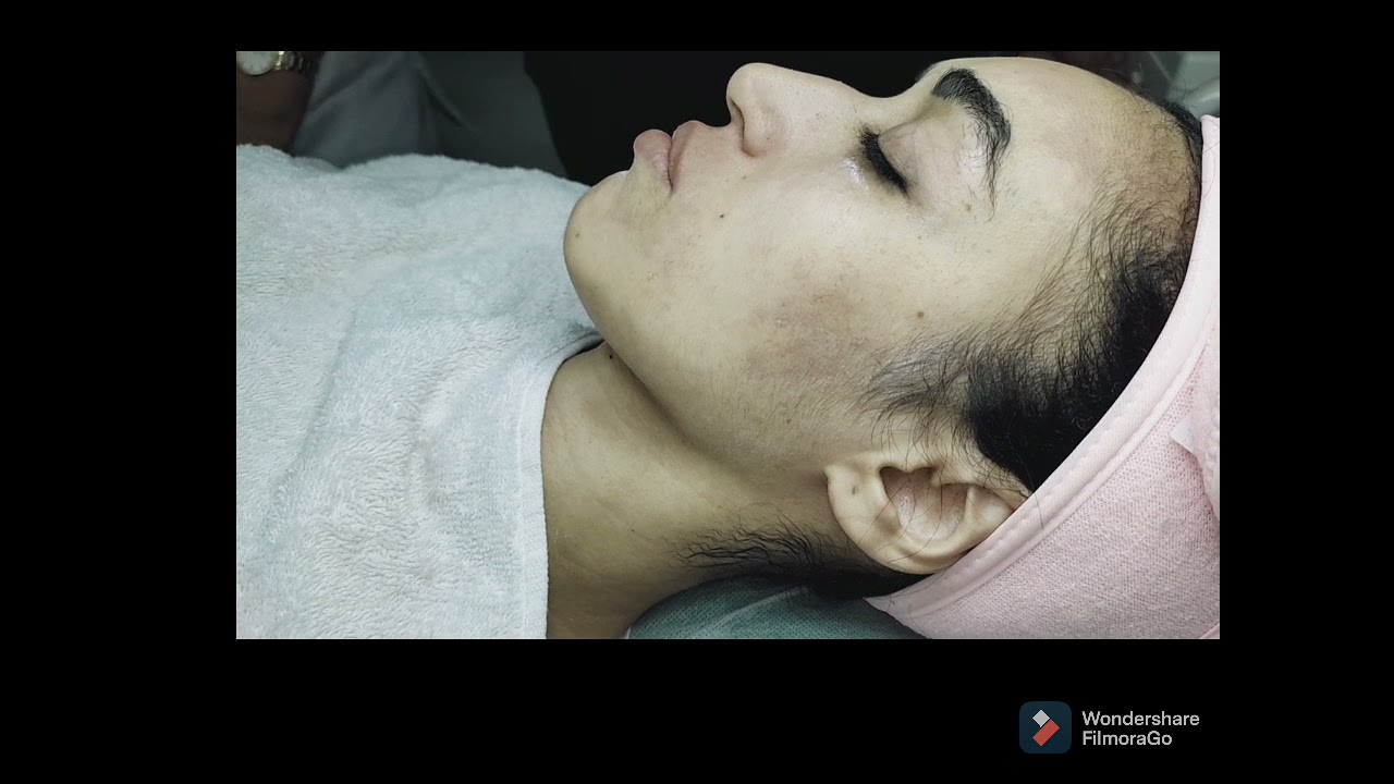 #ازالة شعر الوجه بالشمع بطريقة احترافية للمبتدءات (  épilation de visage a cire chaude)