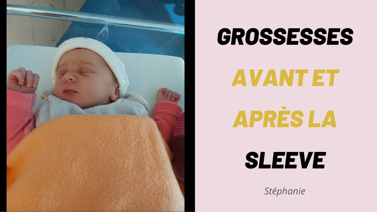 Témoignage GROSSESSE et SLEEVE : Stéphanie enceinte 5 ans après sa sleeve