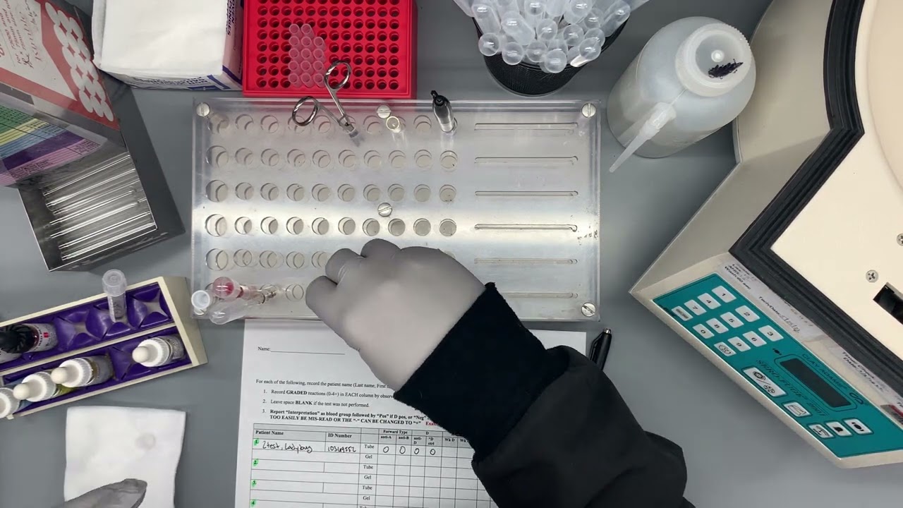 Weak D Procedure